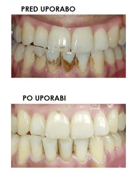 Электрическая зубная щетка с технологией DentalRF™, Silkn ToothWave TW1PE3001